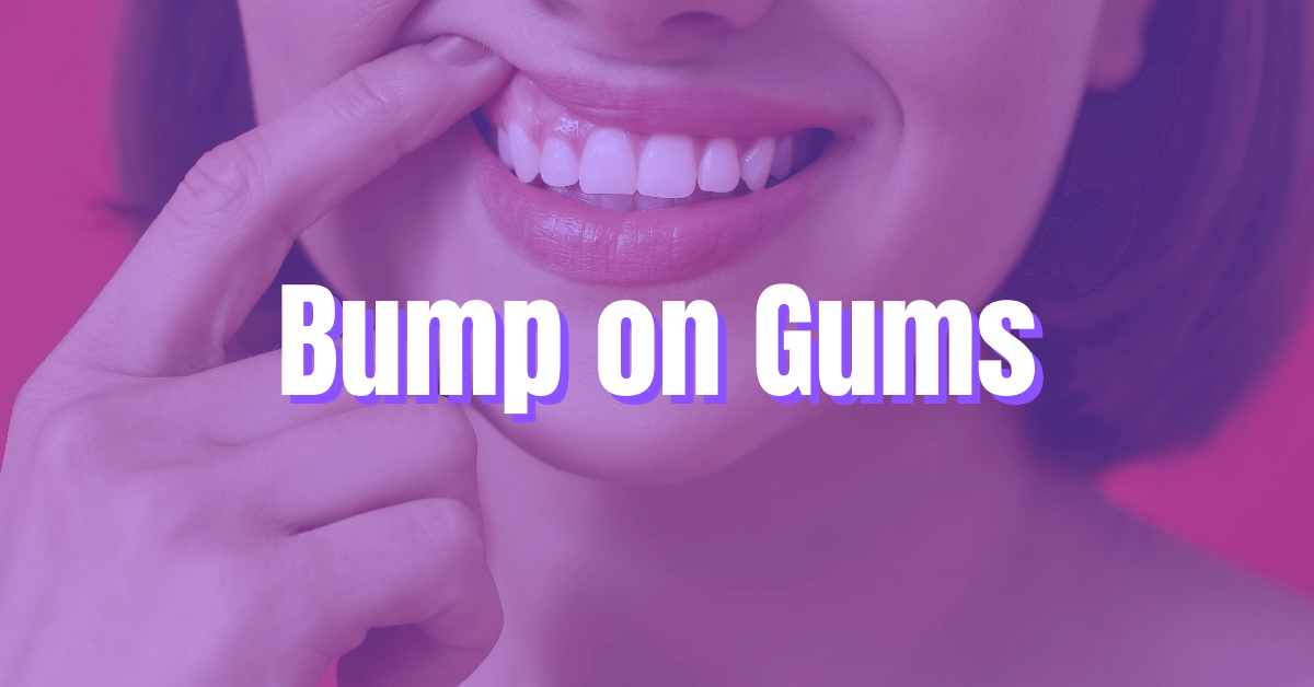 Bump on Gums