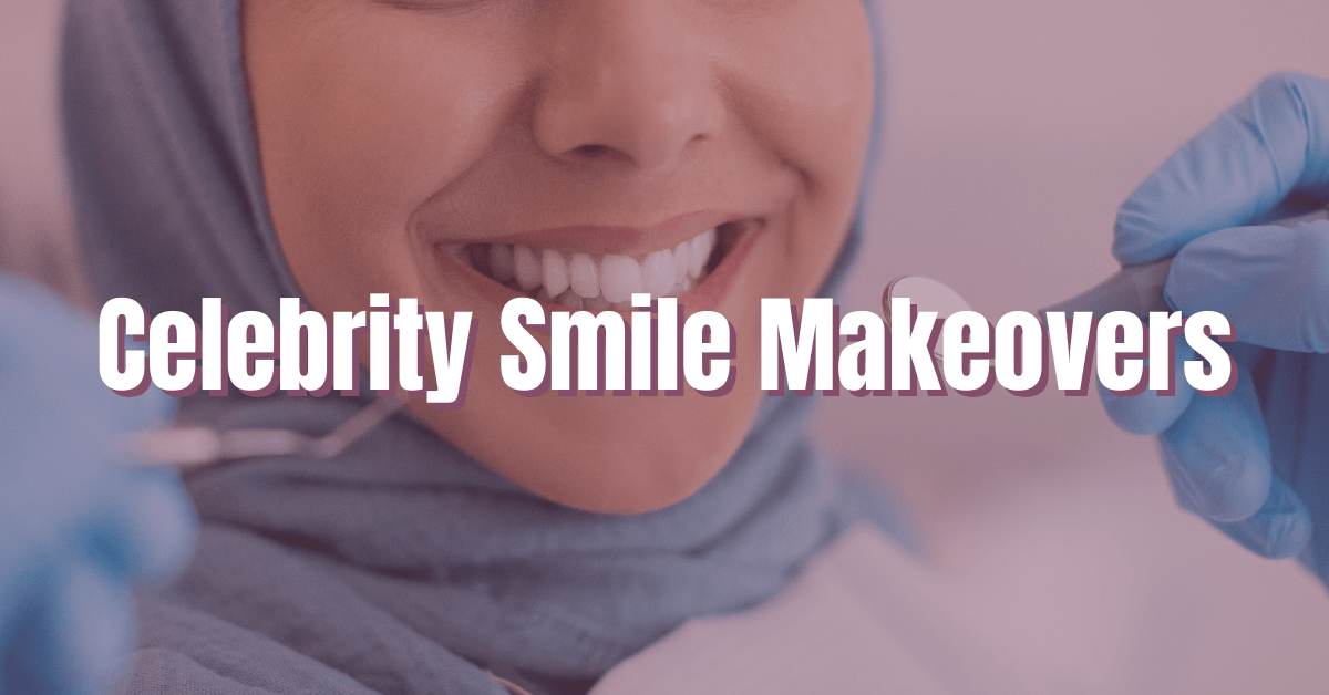 Celebrity Smile Makeovers
